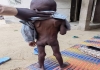 Tchad: une famille demande l'aide pour son  enfant malade 